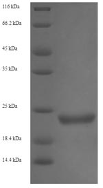 SDS-PAGE