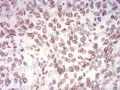 Валидация AntibodySystem RHF98703 (2771)