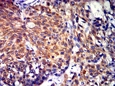 Валидация AntibodySystem RHE12103