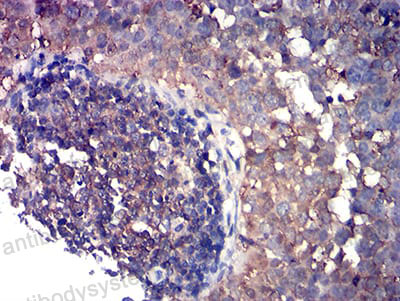 Валидация AntibodySystem RHE03401 (1918)