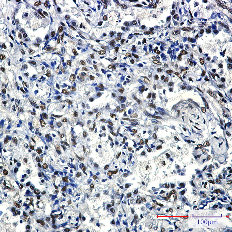 Валидация AntibodySystem RHK31003