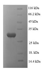SDS-PAGE