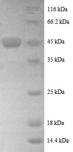 SDS-PAGE
