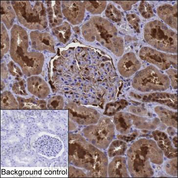 Валидация AntibodySystem RHD86205