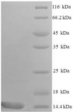 SDS-PAGE