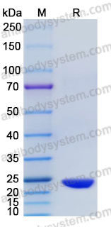EHC07101, SDS-PAGE