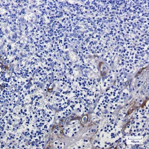 Иммуногистохимия, Cytokeratin 10, ткань миндалин человека