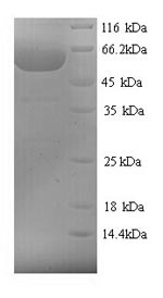 SDS-PAGE