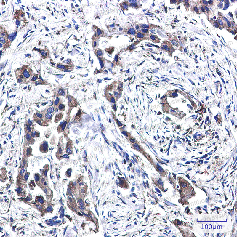 Валидация AntibodySystem RHA90803