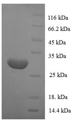 SDS-PAGE