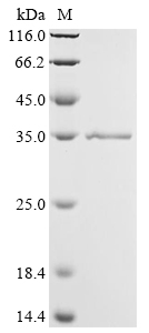 SDS-PAGE
