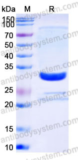 YHD30902, SDS-PAGE