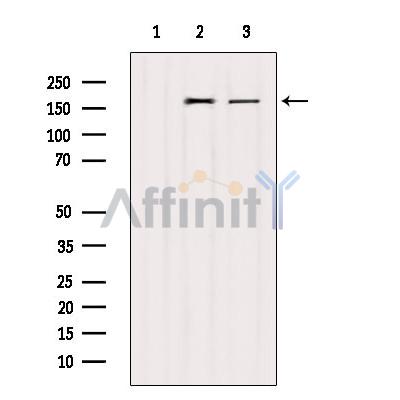 Валидация Affinity AF6041 - 3241