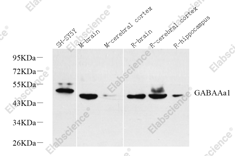 Вестерн-блоттинг, GABAA Receptor alpha1, различные образцы