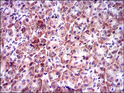 Валидация AntibodySystem RHC27102