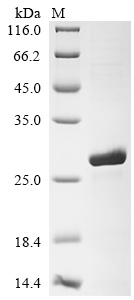 SDS-PAGE