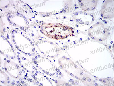 Валидация AntibodySystem RHE39703