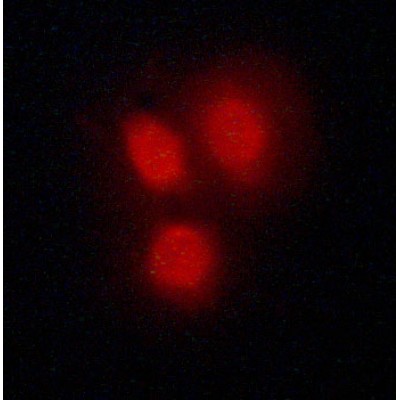 Валидация Affinity AF6159 - 3375