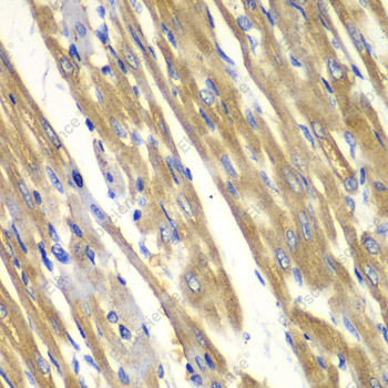 Иммуногистохимия, Tyrosinase, ткань сердца крысы