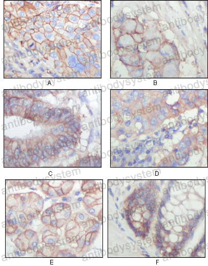 Валидация AntibodySystem RHF04902 (2446)