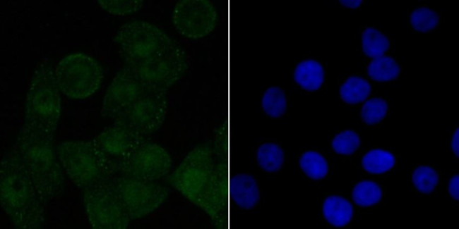 Валидация AssayVector ARM2685(5078)