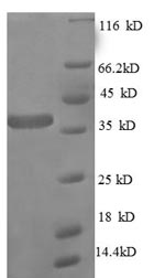SDS-PAGE