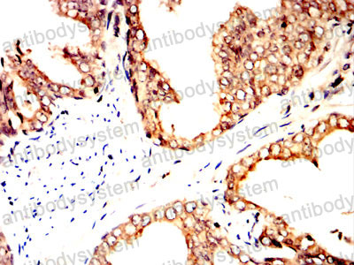 Валидация AntibodySystem RHN88903