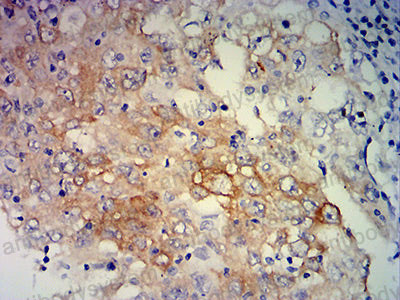 Валидация AntibodySystem RHC29305 (854)