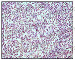 Валидация AntibodySystem RHD10805