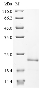SDS-PAGE