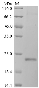 SDS-PAGE