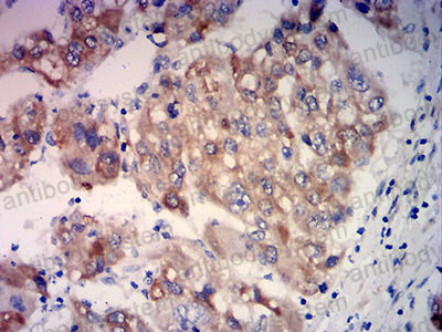 Валидация AntibodySystem RHC42004 (1022)