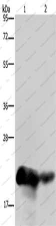 Вестерн-блоттинг, CSH1, ткань плаценты человека и инфильтративной протоковой карциномы молочной железы