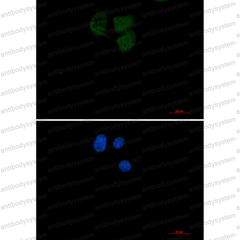 Валидация IF - AntibodySystem RHF40301