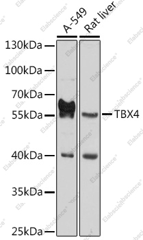 Вестерн-блоттинг, TBX4, различные клеточные линии