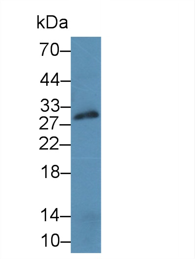 17471