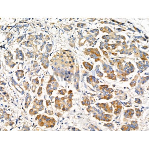 Валидация Affinity DF3671 - 14677