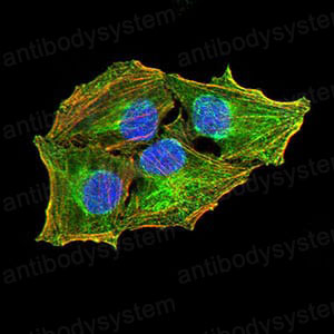 Валидация IF - AntibodySystem RHJ81201