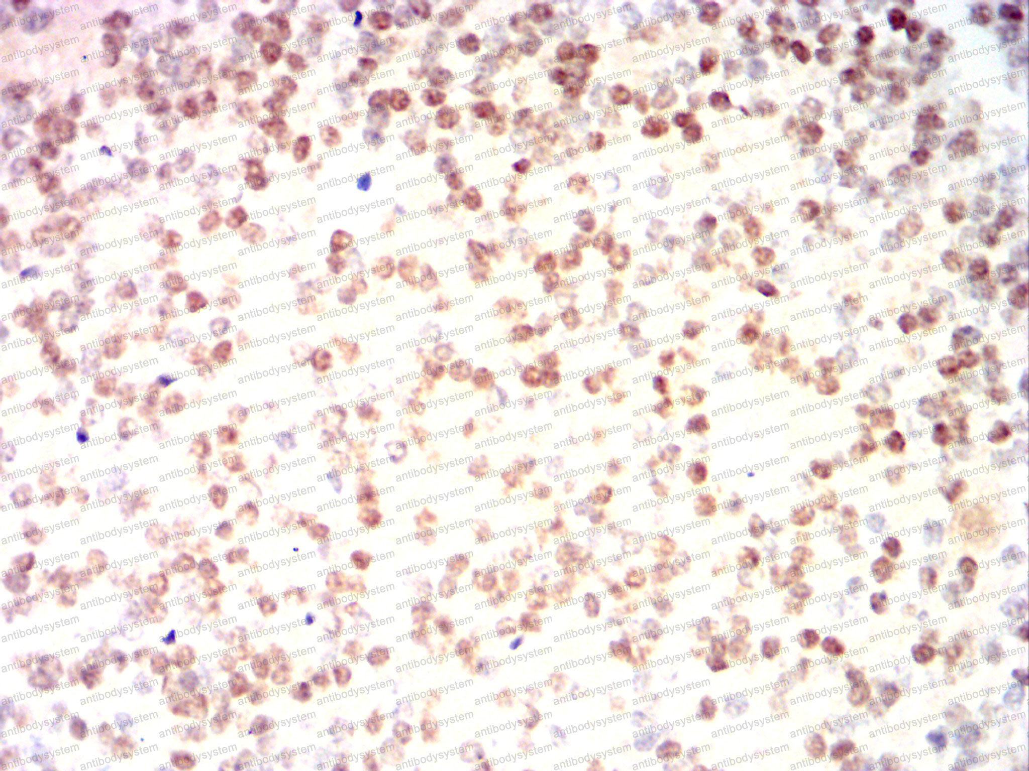 Валидация AntibodySystem RHG90002 (3113)