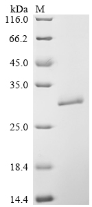 SDS-PAGE