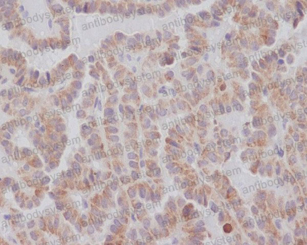 Валидация AntibodySystem RHN59101