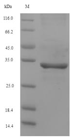 SDS-PAGE