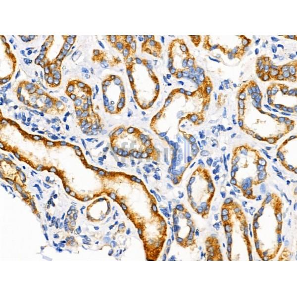 Валидация Affinity DF3512 - 14438