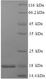 SDS-PAGE