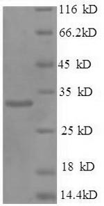SDS-PAGE