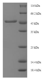 SDS-PAGE