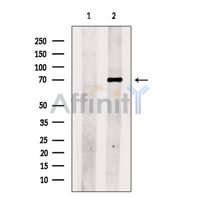 Валидация Affinity DF13647 - 9199