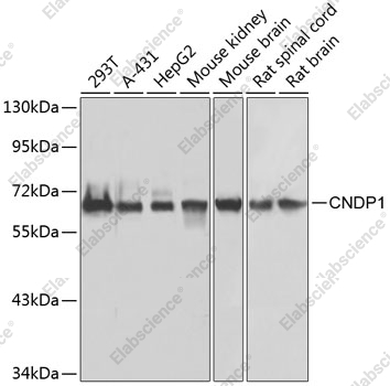 Вестерн-блоттинг, CNDP1, различные клеточные линии