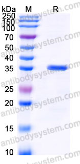 EWJ26301, SDS-PAGE