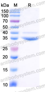 EHC01901, SDS-PAGE